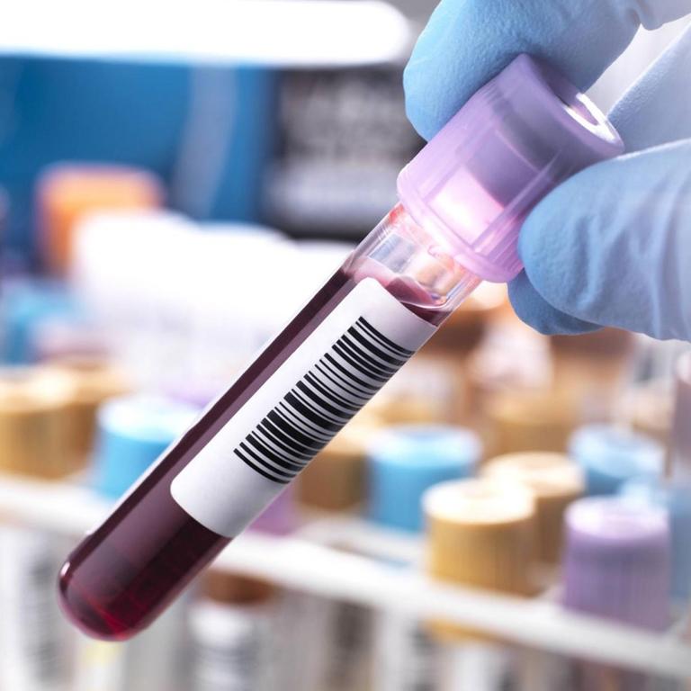 In einem Labor wird eine Blutprobe in einem Röhrchen hochgehalten. 