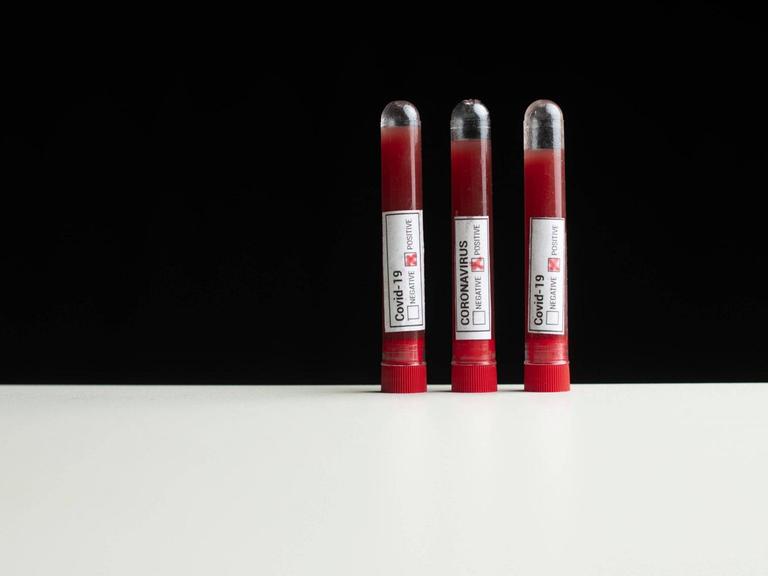 Drei Röhrchen mit Blutproben und dem Etikett "Covid-19" und "Coronavirus" stehen vor dunklem Hintergrund auf einer weißen Fläche.
