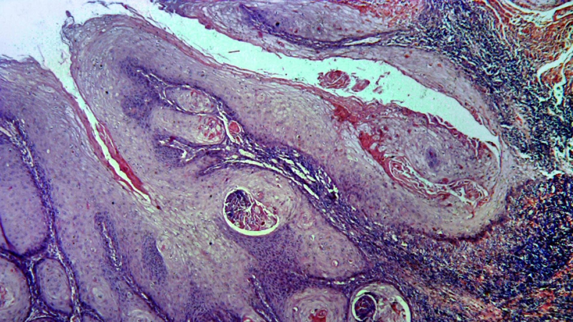 Violett-rötliches, schlierenartig angeordnetes Zellmaterial in einer mikroskopischen Ansicht, die den Eindruck von abstrakter Kunst entstehen lässt.