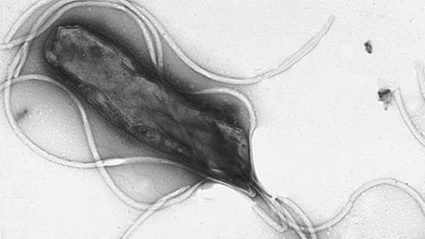 Helicobacter pylori kann Magengeschwüre und so auch Magenkrebs verursachen.