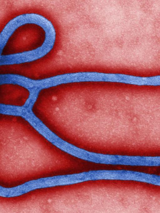 Farbige Elektronen-mikroskopische Darstellung der ultrastrukturellen Morphologie eines Ebola Virus Virion.