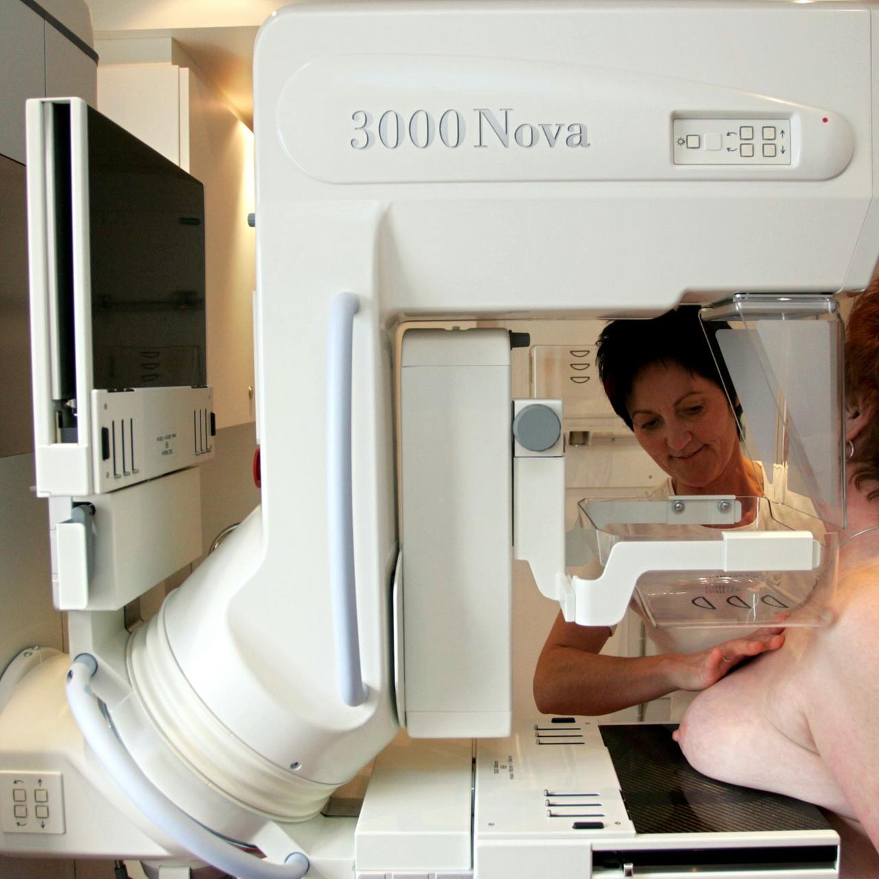 Mammographie-Screening - Ärztevereinigung ruft zur Brustkrebs-Vorsorge auf