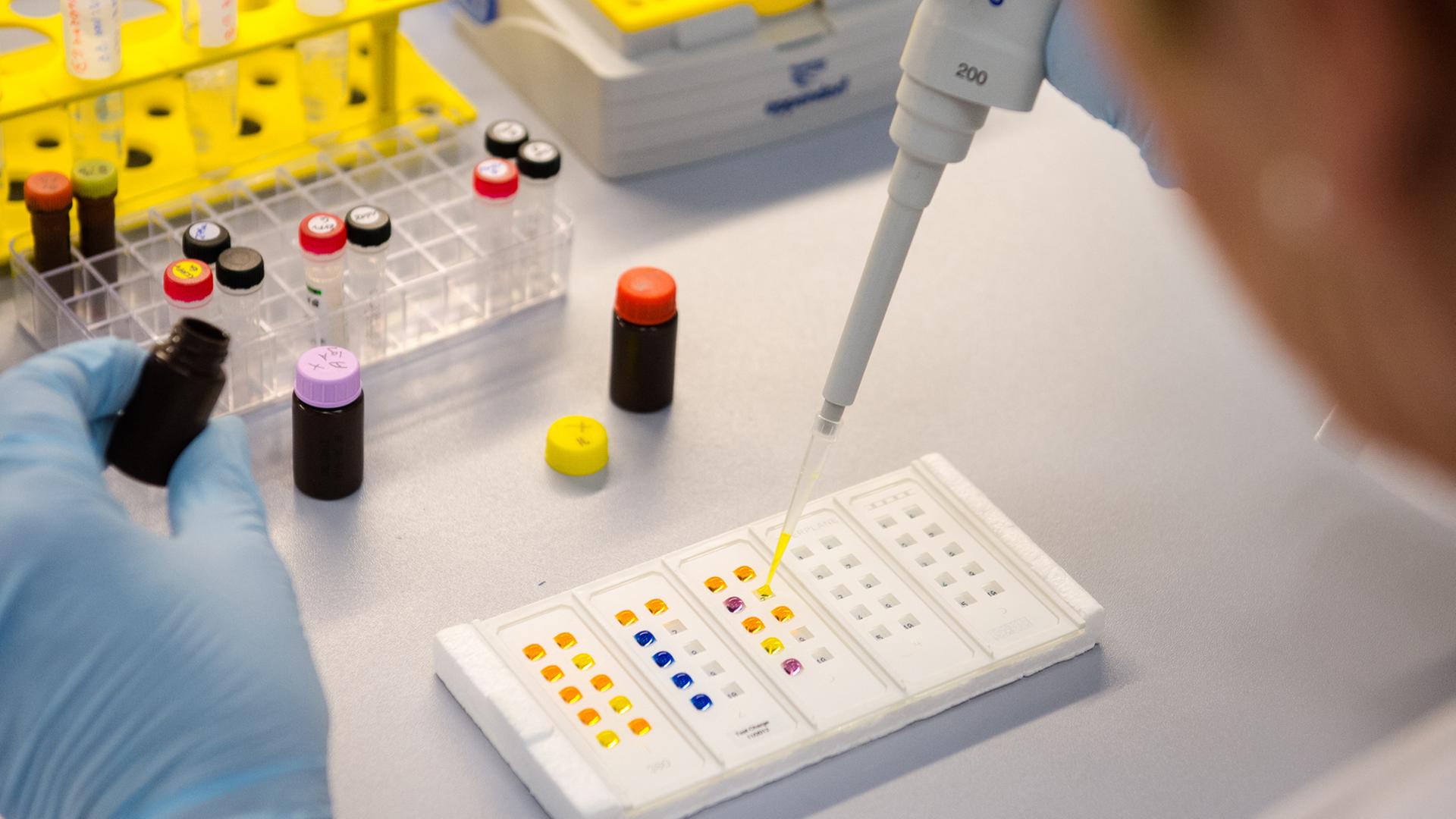 Eine Labormitarbeiterin untersucht in Dassow (Mecklenburg-Vorpommern) bei der Firma Euroimmun bei einem Immunfluorenztest eine Probe mit Antikörpern. Für den Nachweis des Zika-Virus setzt Brasilien Diagnosetechnik ein, die in Nordwestmecklenburg produziert wird.