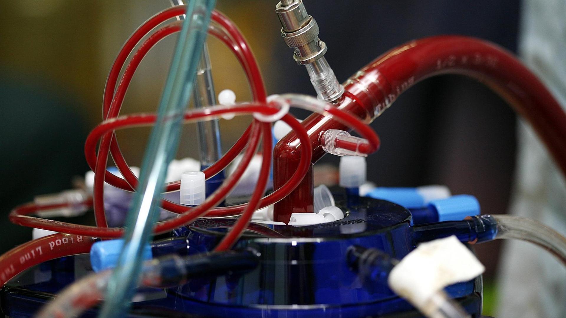Die Nahaufnahme einer Herz-Lungen-Maschine zeigt mehrere blutgefüllte Schläuche, die zu und von einem metallene Zylinder führe Nahaufnahme eines modernen kardiopulmonalen Bypass- vulgo Herz-Lungen-Maschine
