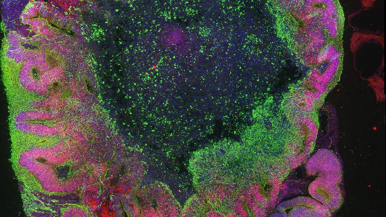 Ein Gehirn-Organoid nach 35 Tagen