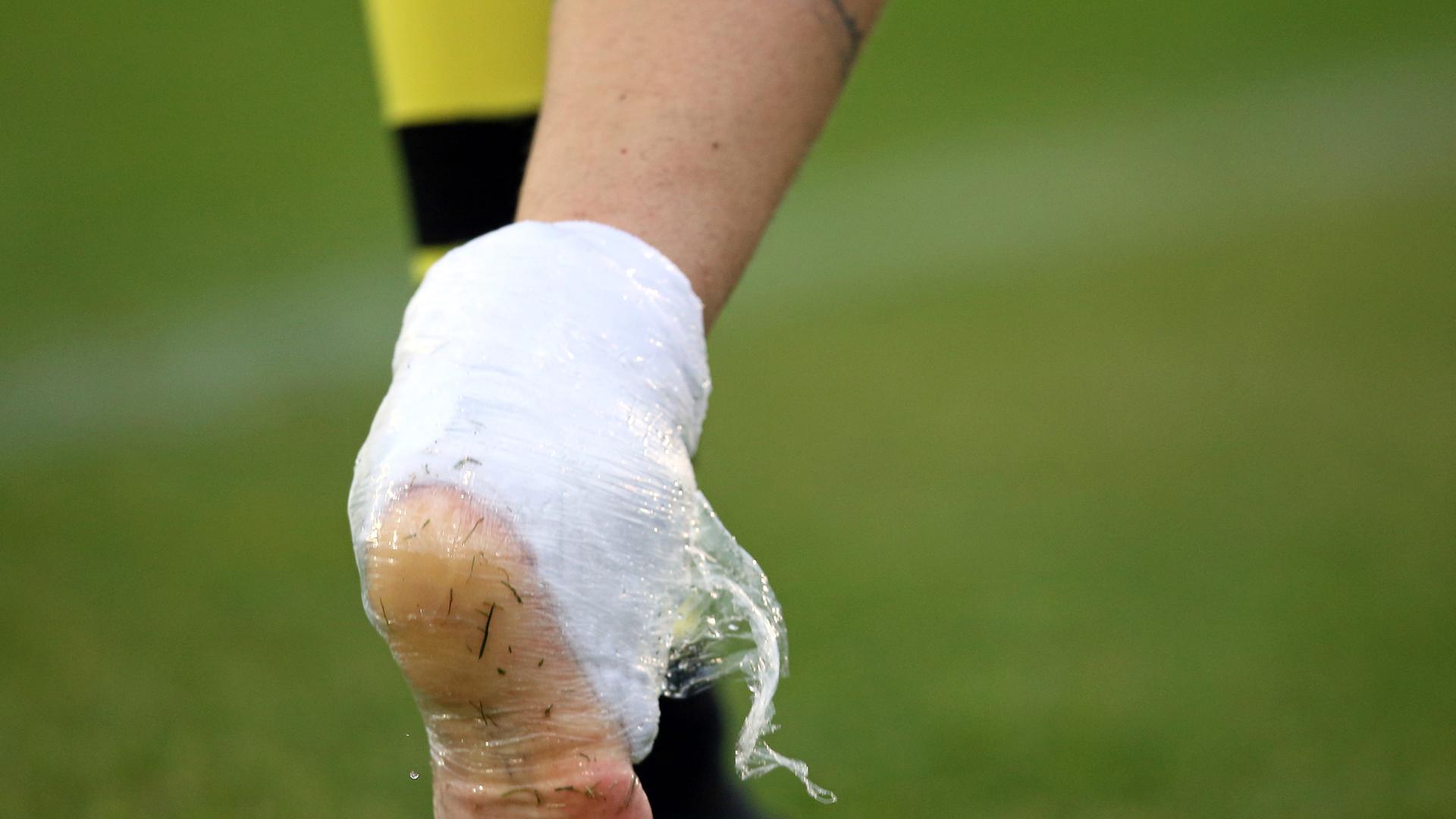 Kevin Großkreutz von Borussia Dortmund verlässt bei einem Testspiel seines Vereins mit einem verbundenen Sprunggelenk den Platz.
