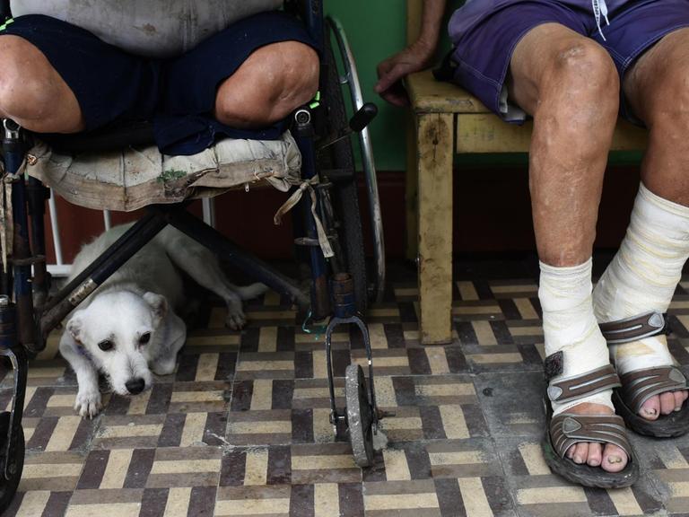 Lepra-Kranke im Wartezimmer eines Krankenhauses in Rio de Janeiro, Brasilien.