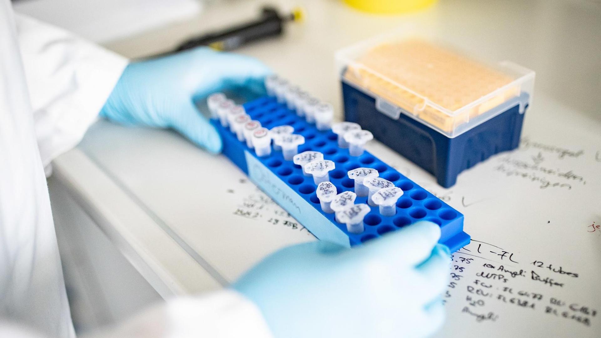 Ein Doktorand der Heinrich-Heine-Universität Düsseldorf arbeitet an Proben für die Coronavirus-Forschung. Die Forschungsprojekte umfassen Immunität nach ausgeheilter Infektion und Forschungsdaten zur Wirksamkeit und Bedeutung von Remdesivir in der klinischen Anwendung.