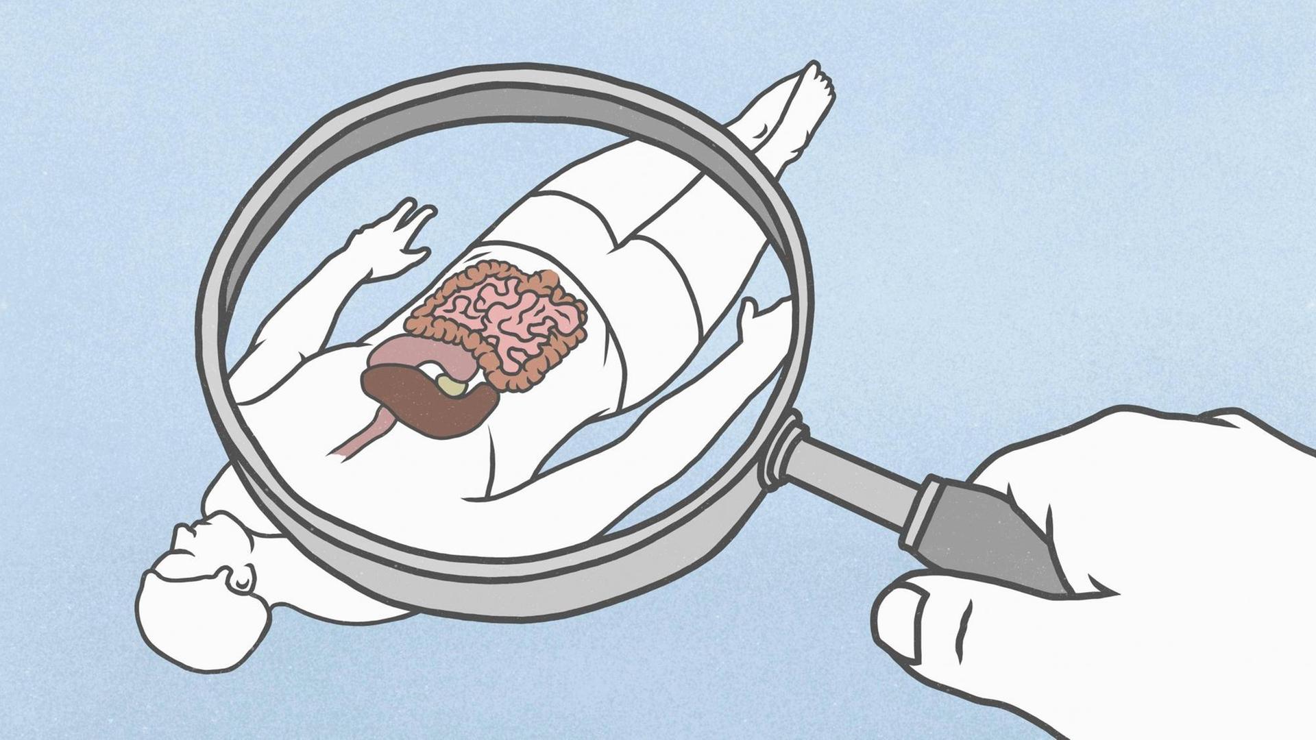 Illustration. Eine Hand hält eine Lupe hinter der ein Mensch liegt dessen Organe zu sehen sind.