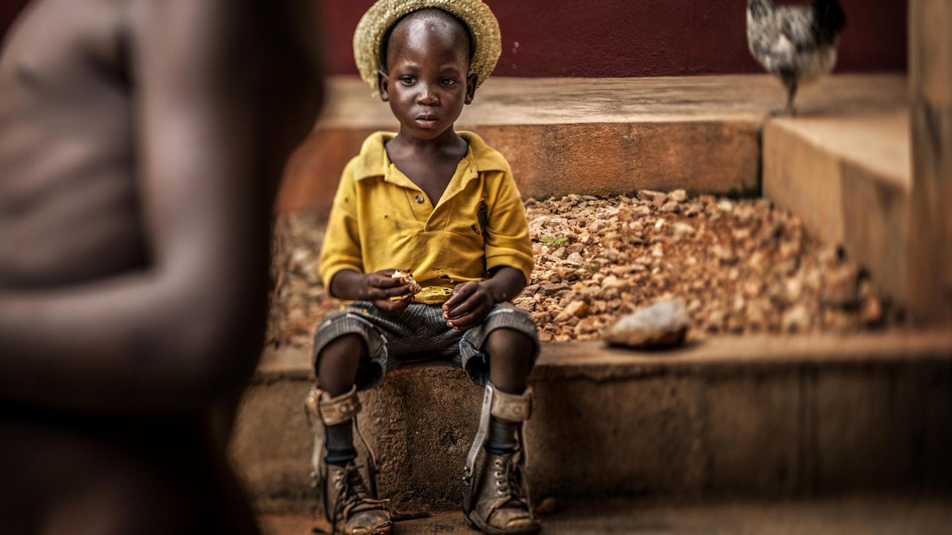 Das beste Unicef-Foto von diesem Jahr. Ein Junge mit Bein-Prothesen sitzt in einem Heim in dem west-afrikanischen Land Togo.