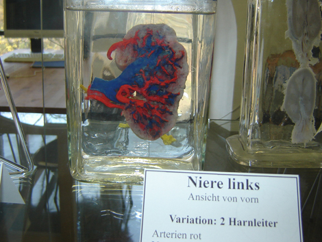Korrosionspräparat einer menschlichen Niere. Die roten Arterien und die blauen Venen wurden mit Kunststoff ausgegossen.