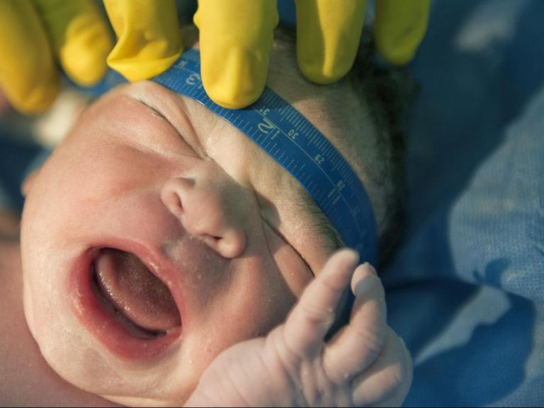Eine Krankenschwester misst den Schädelumfang eines Neugeborenen. 