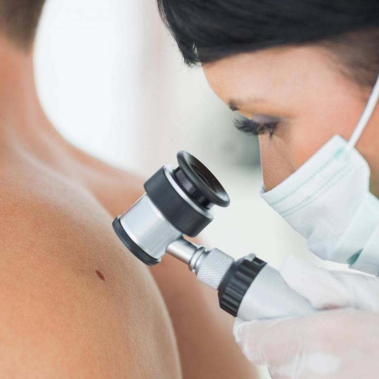 Eine Hautärztin untersucht das Muttermal eines Patienten (Symbolfoto).