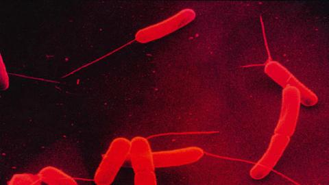 Darmbakterien vom Stamm E. coli können auch gefährlich werden.