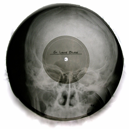 Blues-Schallplatte, gepresst auf ein Röntgenbild