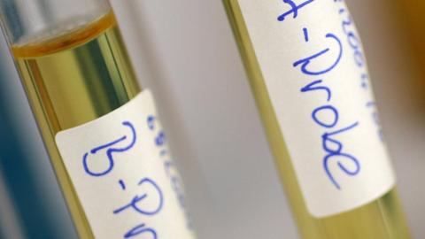 Eine A-Probe und B-Probe beim Dopingtest.