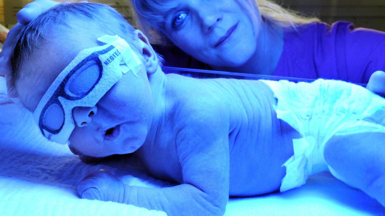 Ein Baby mit einer Spezialbrille liegt zur Phototherapie in einem Wärmebett.
