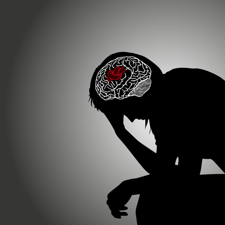 Grafik zeigt Silhouette eines Menschen, in dessen Gehirn ein Knoten sitzt