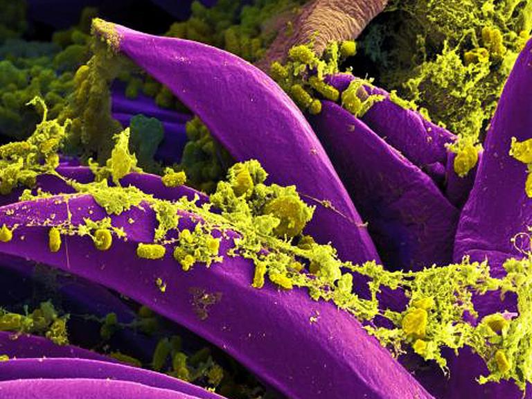 Produced by the National Institute of Allergy and Infectious Diseases (NIAID) in 2011, this digitally-colorized scanning electron micrograph (SEM) depicts a number of purple-colored Yersinia pestis bacteria that had gathered on the proventricular spines of a Xenopsylla cheopis flea. These spines line the interior of the proventriculus, a part of the flea_s digestive system. The Y. pestis bacterium is the pathogen that causes bubonic plague.