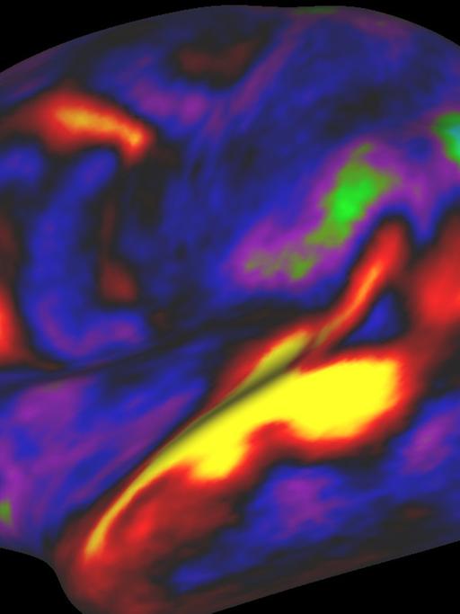 Eine Computersimulation des menschlichen Gehirns mit roten bis blauen Flächen. Je rötlicher ein Areal, desto mehr Myelin ("weiße Substanz") gibt es dort.
