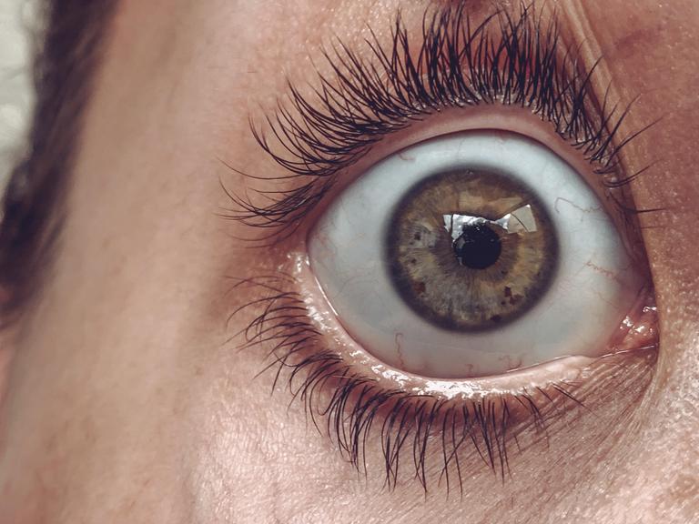 Ein weit aufgerissenes menschliches Auge