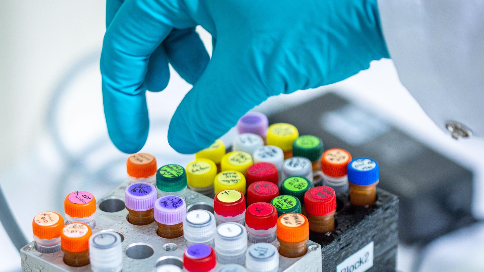 Unterschiedliche Substanzen stehen auf Kühlblöcken in einem PCR-Labor. Hier werden Proben für spezifische DNA- oder RNA-Tests vorbereitet. So können Erreger von Infektionskrankheiten wie Viren und Bakterien zuverlässig nachgewiesen werden. Unterschiedliche Substanzen stehen auf Kühlblöcken in einem PCR-Labor. Hier werden Proben für spezifische DNA- oder RNA-Tests vorbereitet. So können Erreger von Infektionskrankheiten wie Viren und Bakterien zuverlässig nachgewiesen werden.