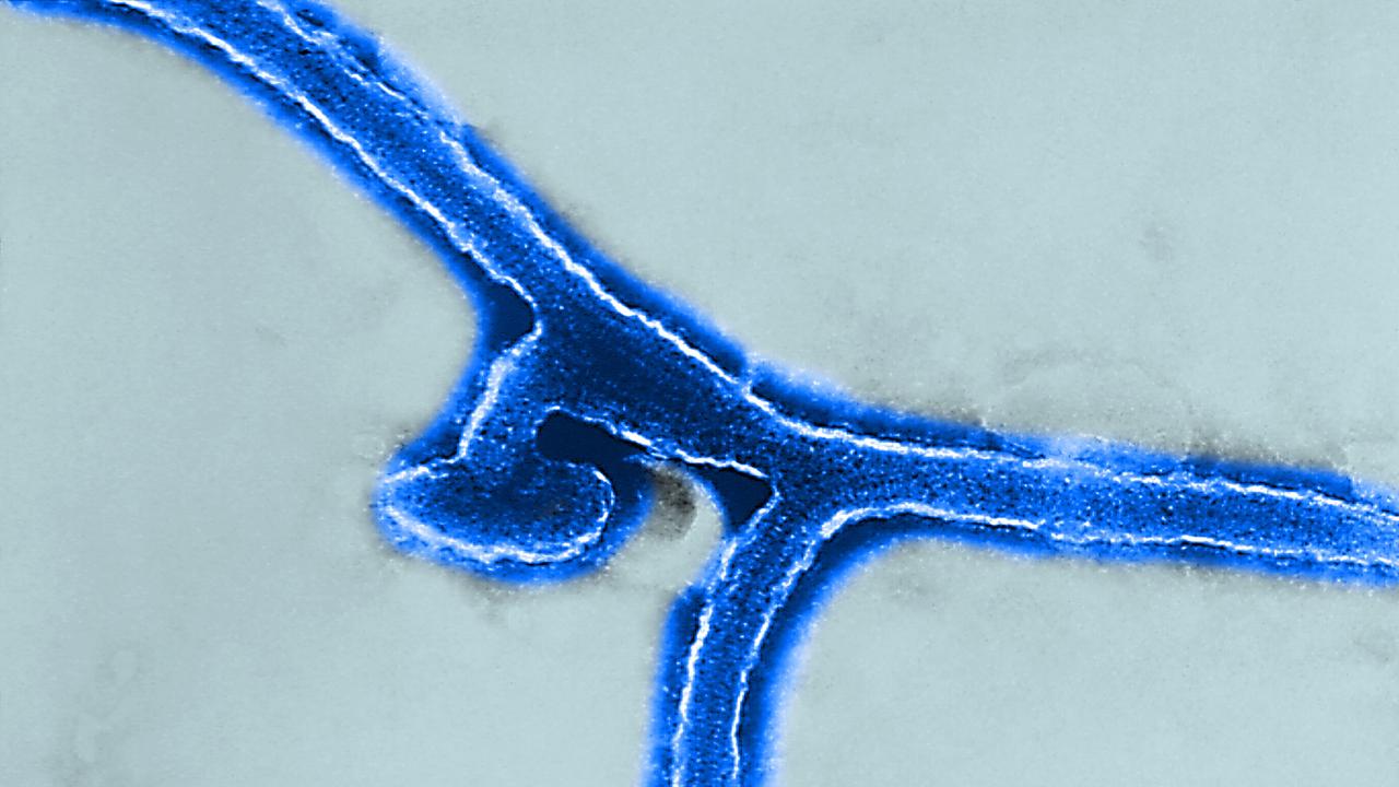 Marburg-Virus unter dem Transmissionselektronenmikroskop