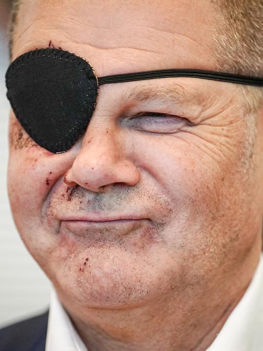 Bundeskanzler Olaf Scholz (SPD) mit Augenklappe.