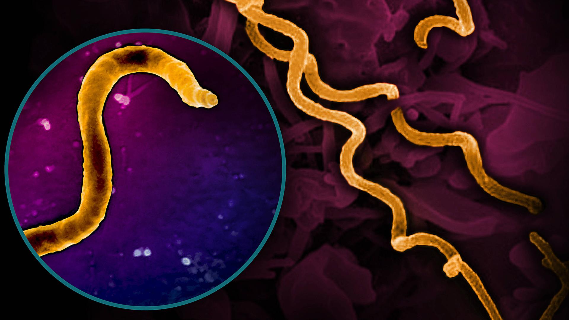 Elektronische mikrografische Darstellung des Bakteriums Treponema pallidum, das Syphilis hervorruft. Es ist ein schraubenförmig gewundenes Bakterium. 