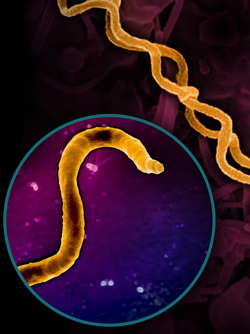 Elektronische mikrografische Darstellung des Bakteriums Treponema pallidum, das Syphilis hervorruft. Es ist ein schraubenförmig gewundenes Bakterium. Elektronische mikrografische Darstellung des Bakteriums Treponema pallidum, das Syphilis hervorruft. Es ist ein schraubenförmig gewundenes Bakterium.