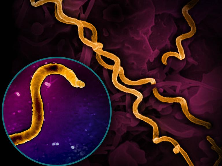 Elektronische mikrografische Darstellung des Bakteriums Treponema pallidum, das Syphilis hervorruft. Es ist ein schraubenförmig gewundenes Bakterium. Elektronische mikrografische Darstellung des Bakteriums Treponema pallidum, das Syphilis hervorruft. Es ist ein schraubenförmig gewundenes Bakterium.