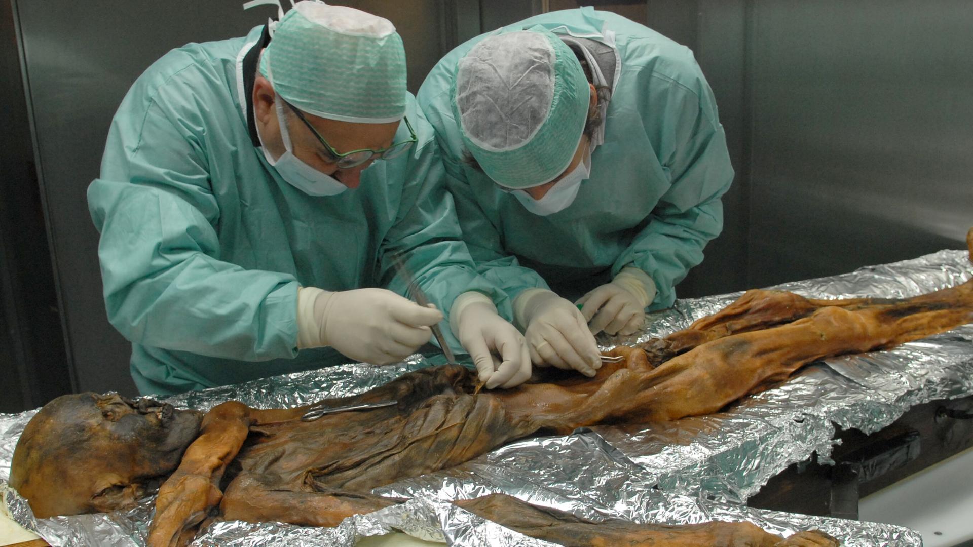 Wissenschaftler untersuchen die rund 5000 Jahre alte Gletschermumie "Ötzi". Das Skelett liegt auf einer metallenen Folie. Die Forscher berühren die menschlichen Überreste. Sie tragen OP-Kittel, Gummihandschuhe und Mundschutz. 