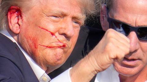 Donald Trump wurde bei einem Anschlag am Ohr verletzt
