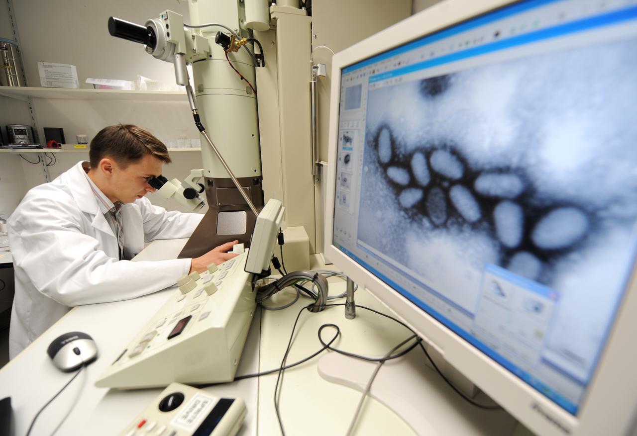 Im Chemischen und Veterinäruntersuchungsamt (CVUA) Stuttgart wird unter einem Elektronenmikroskop einen Pockenvirus von einem Schaf untersucht.