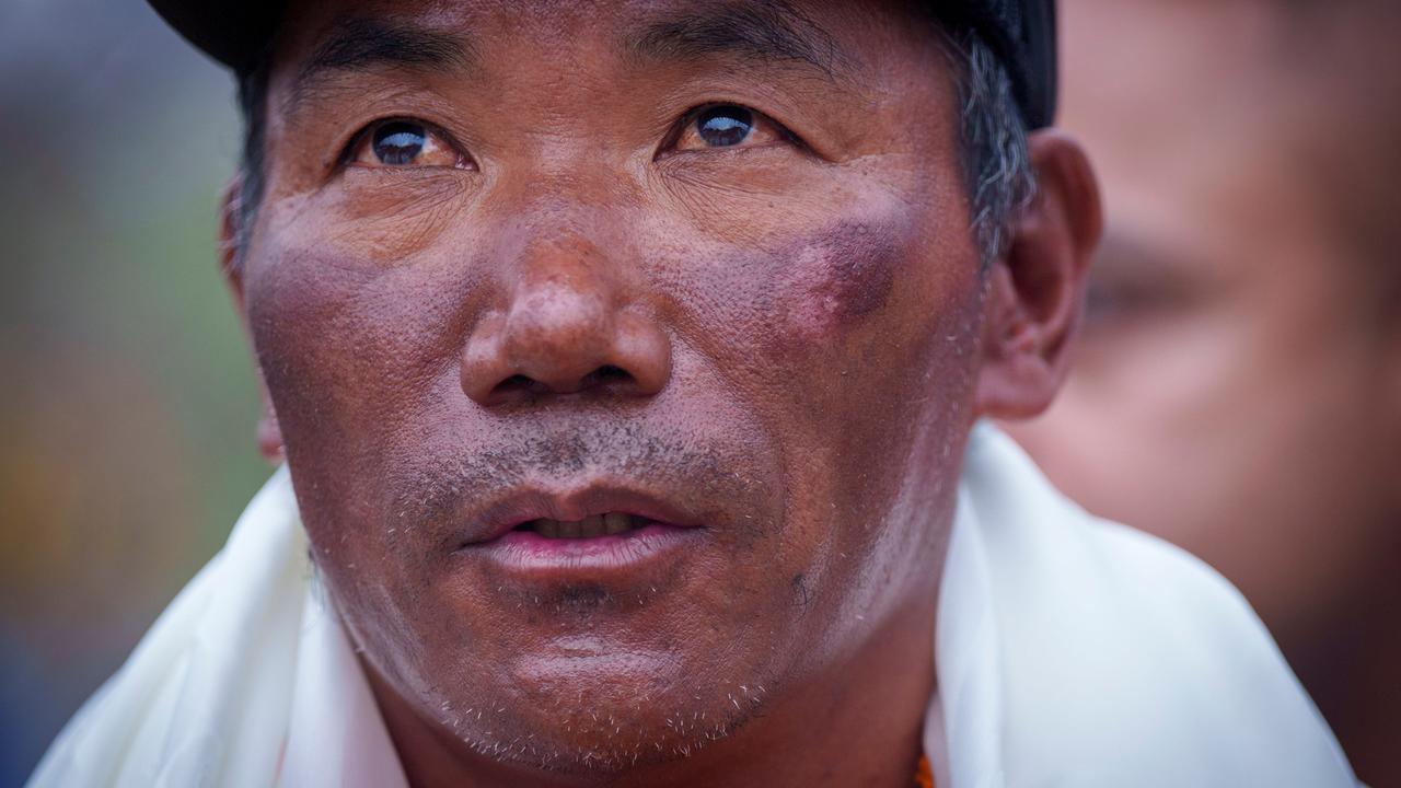 Ein Nepalese schaut ein bisschen erschöpft in die Kamera. Um seinen Hals trägt er ein weißes Handtuch. Auf seiner Wange ist ein dunkelroter Fleck zu sehen.