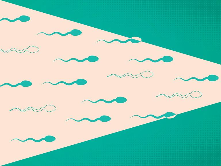Illustration von Spermien die sich von links nach rechts bewegen.