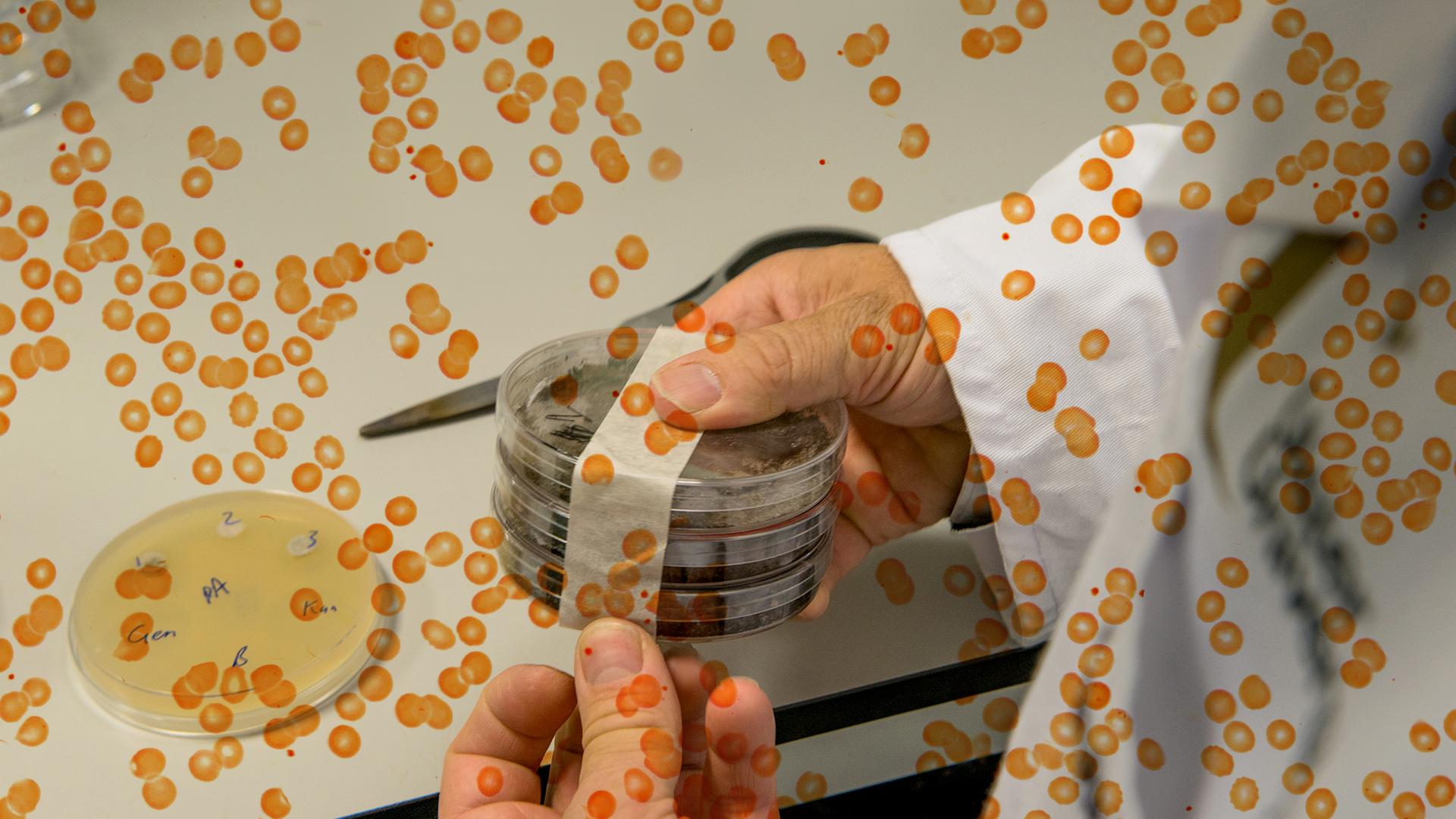 Eine Person hält mehrer übereinander gestapelte Petrischalen in der Hand. Das Foto wird von einer Grafik aus orangen Punkten überlagert.