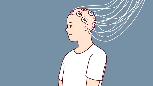 Eine grafisches Bild zeigt einen Menschen mit Elektroden am Kopf.