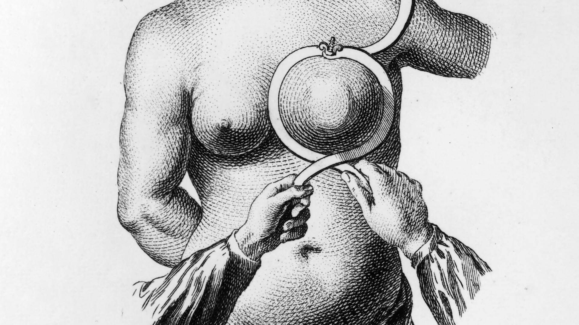 Historische Grafik einer Frau, deren Brust mit einem medizinischen Gerät was an eine Art Ring erinnert, umschlossen wird.