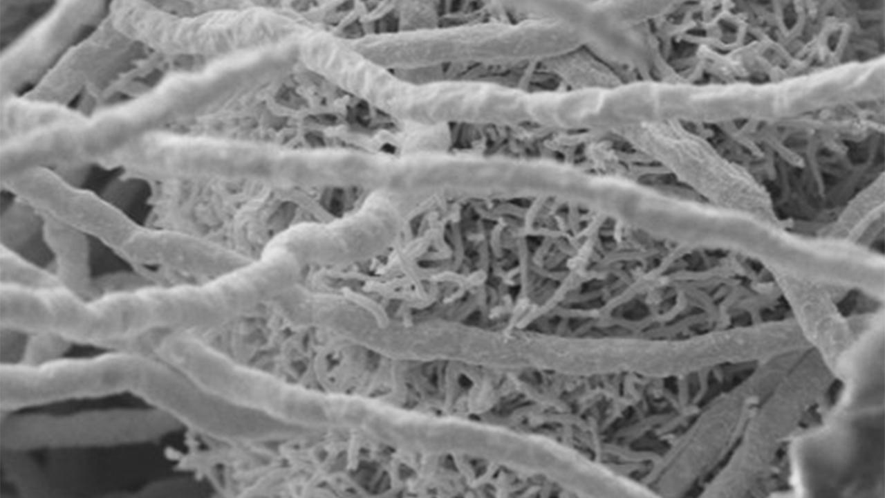 Gemeinsame Kultur des Pilzes Aspergillus fumigatus und des Bakteriums Streptomyces rapamycinicus in einer elektronenmikroskopischen Aufnahme