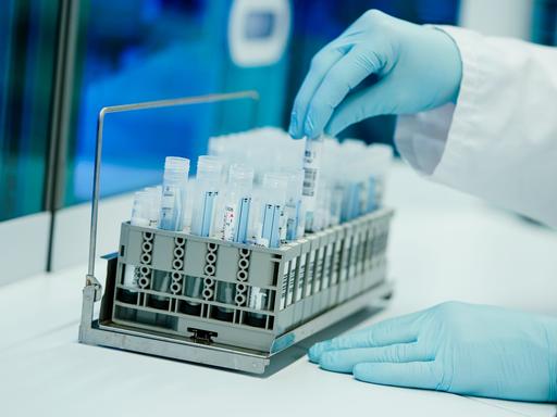 Ein Mitarbeiter hält in einem Coronatest-Labor der Limbach Gruppe PCR-Teströhrchen in den Händen (Archivbild).