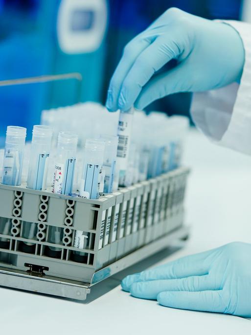 Ein Mitarbeiter hält in einem Coronatest-Labor der Limbach Gruppe PCR-Teströhrchen in den Händen (Archivbild).