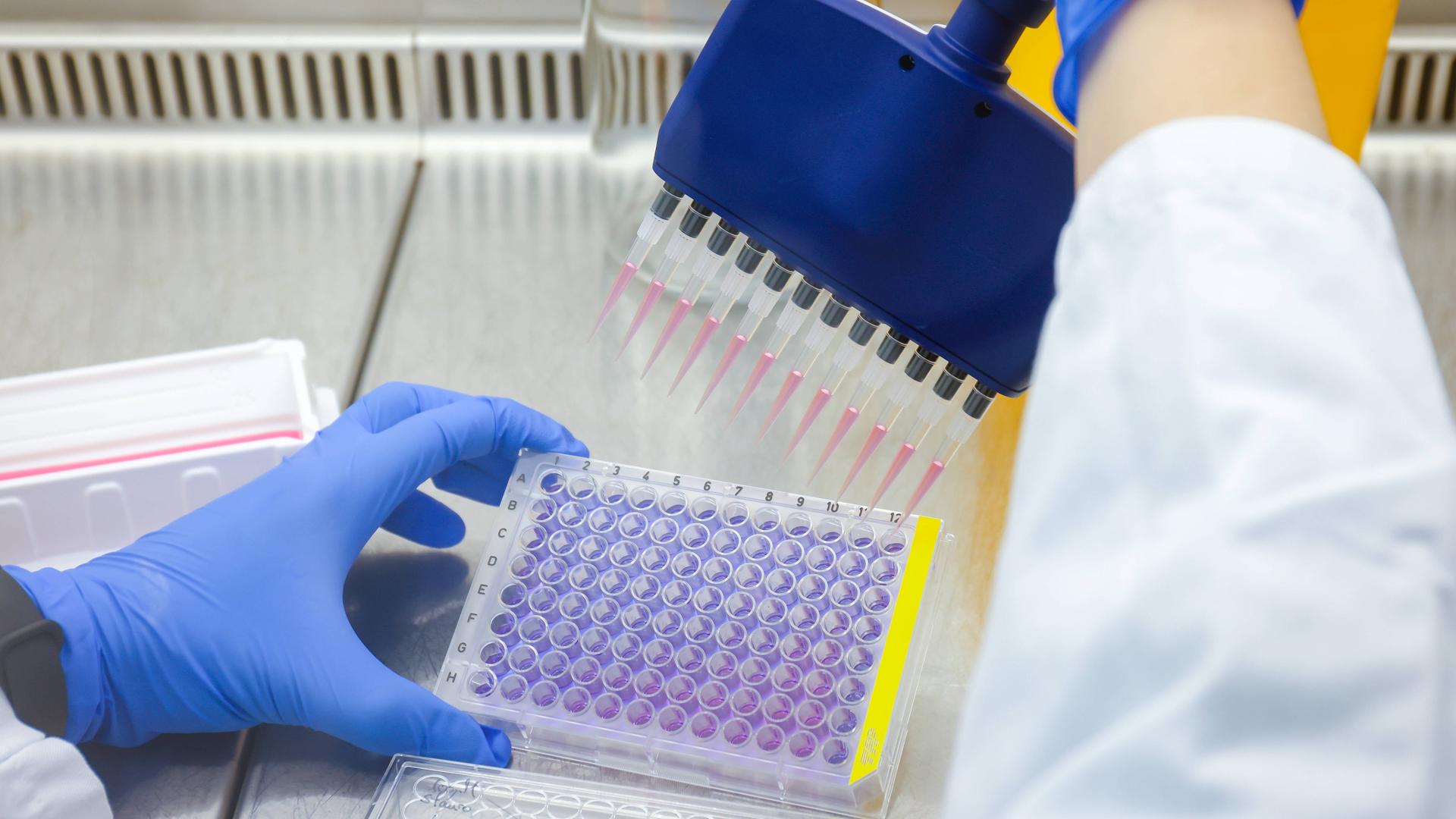 Eine Mitarbeiterin im Bereich der Immunologie und Infektologie am Biomedizinischen Zentrum II des Universitaetsklinikums Bonn untersucht molekulare und funktionelle Eigenschaften von Tumorzellen in Zellkultur.
