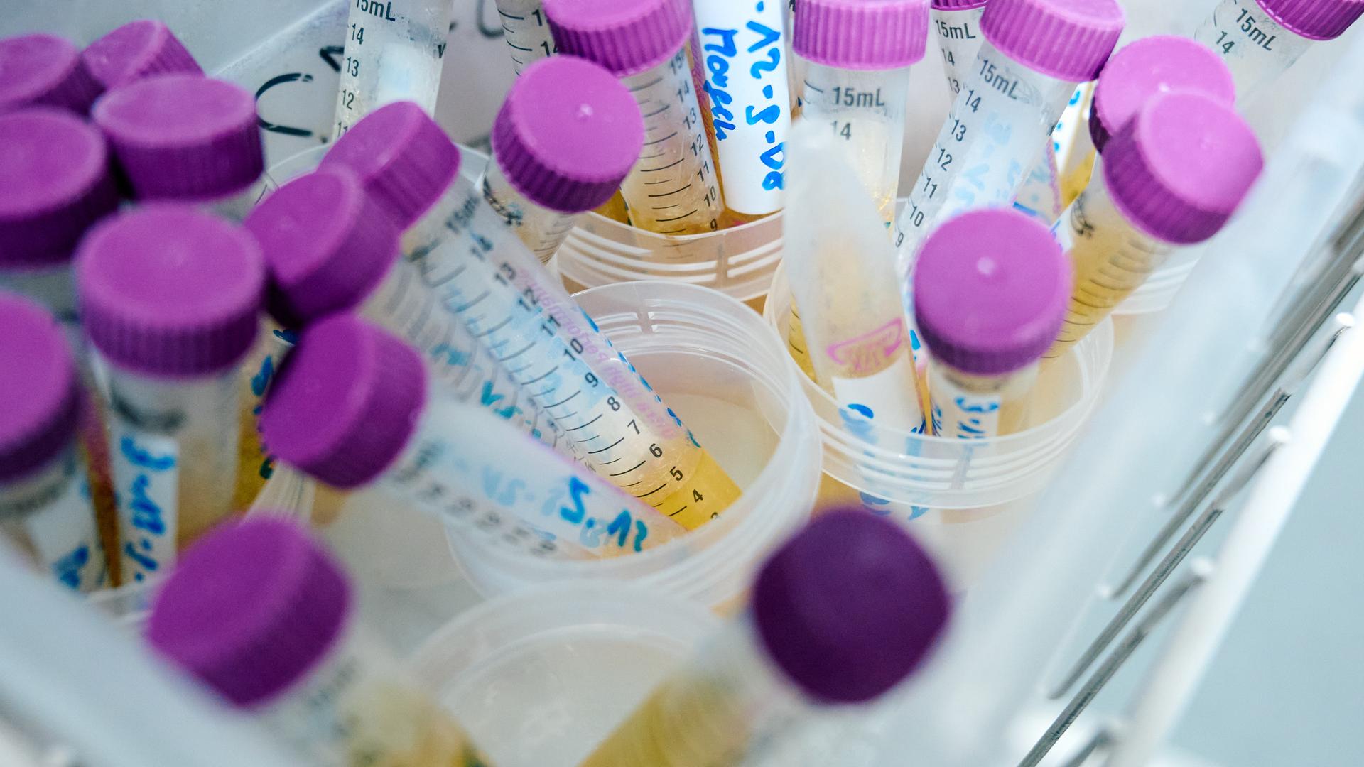 Tiefgefrorene Urinproben liegen in einem Labor des Landesamt für Natur, Umwelt und Verbraucherschutz (Lanuv) Nordrhein-Westfalen in einem Kühlschrank.