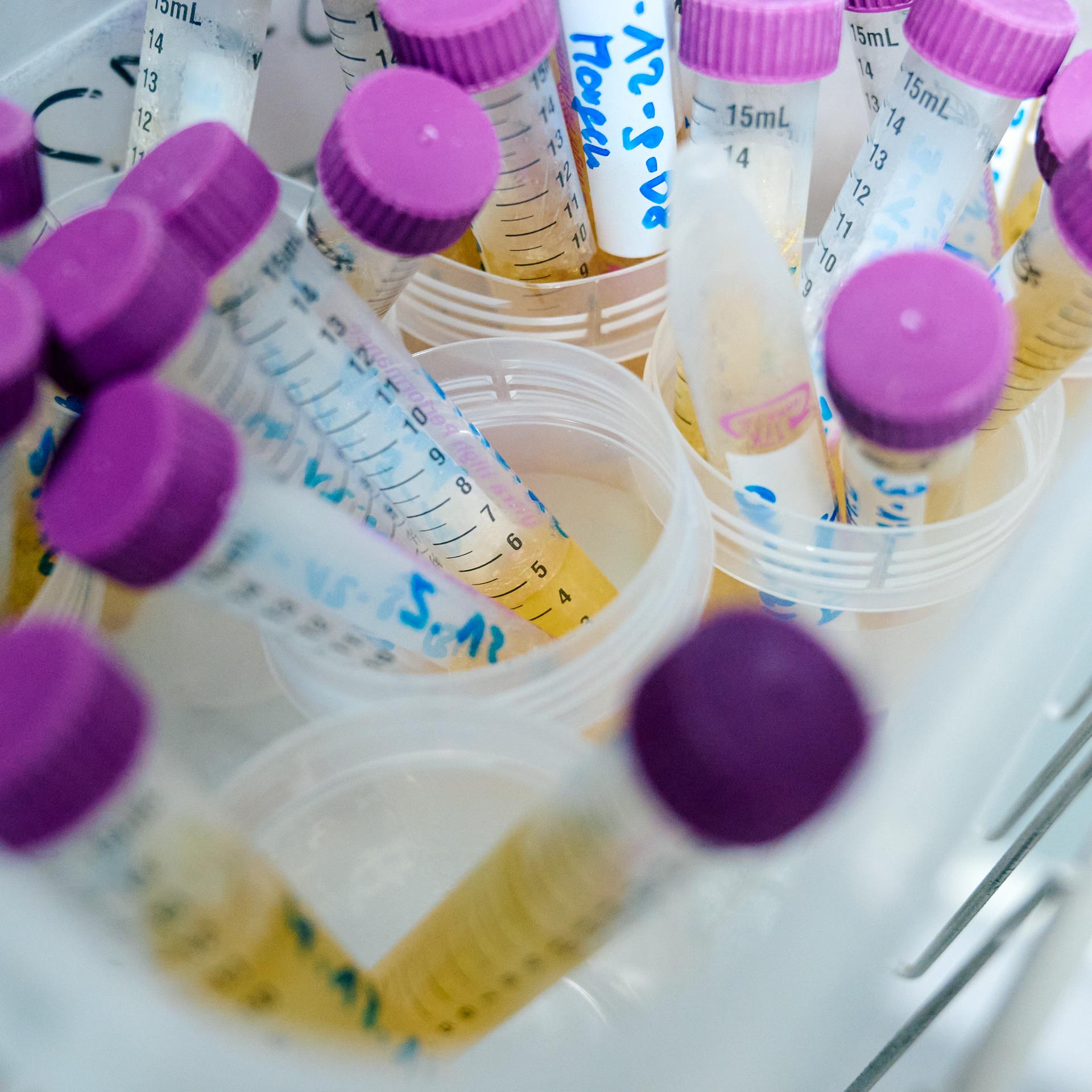 Schadstoffe - Umweltbundesamt: Rückstände von gefährlichem Weichmacher weiterhin im Urin fast aller Kinder