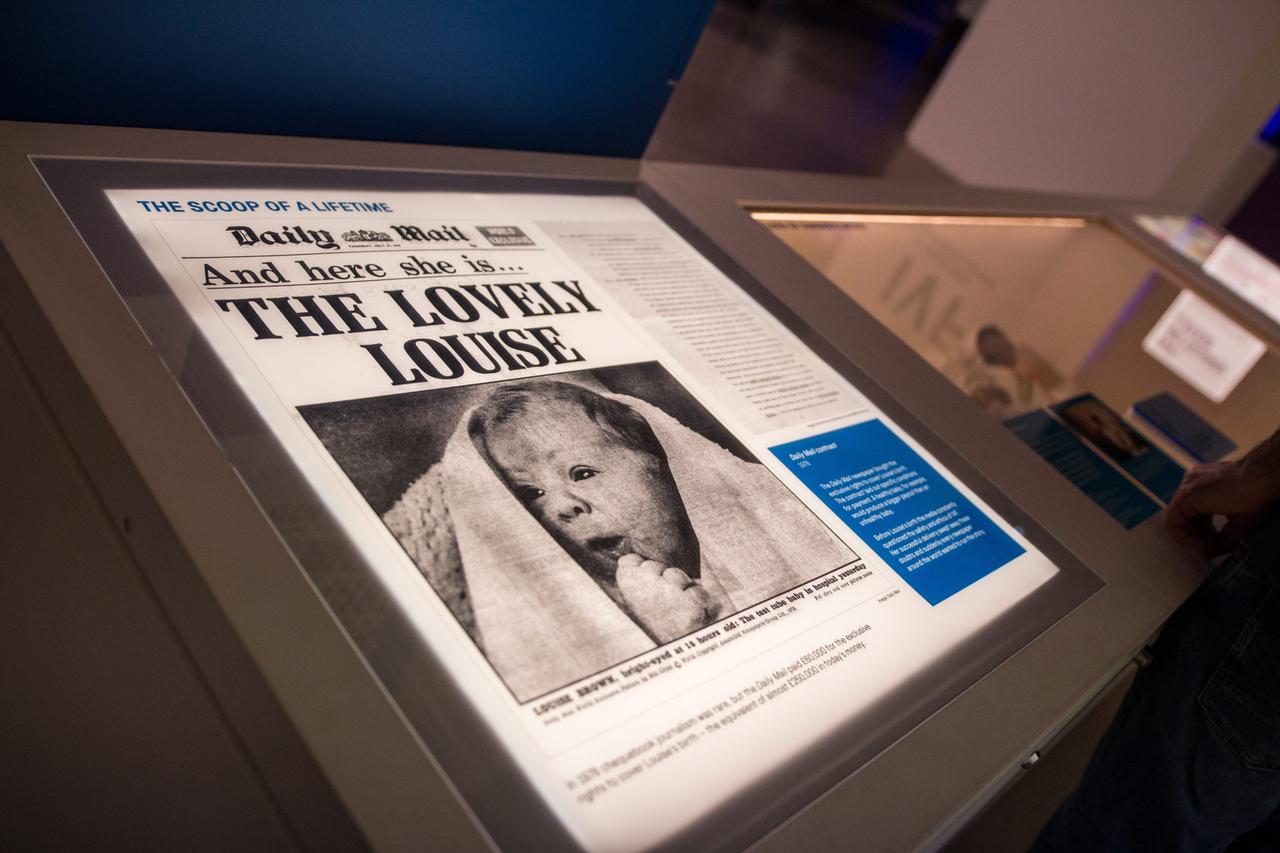 Ausstellungseröffnung im Science Museum London zum 40. Geburtstag von Louise Brown, dem ersten mit künstlicher Befruchtung gezeugten Menschen der Welt. Aufgenommen am 23. Juli 2018.