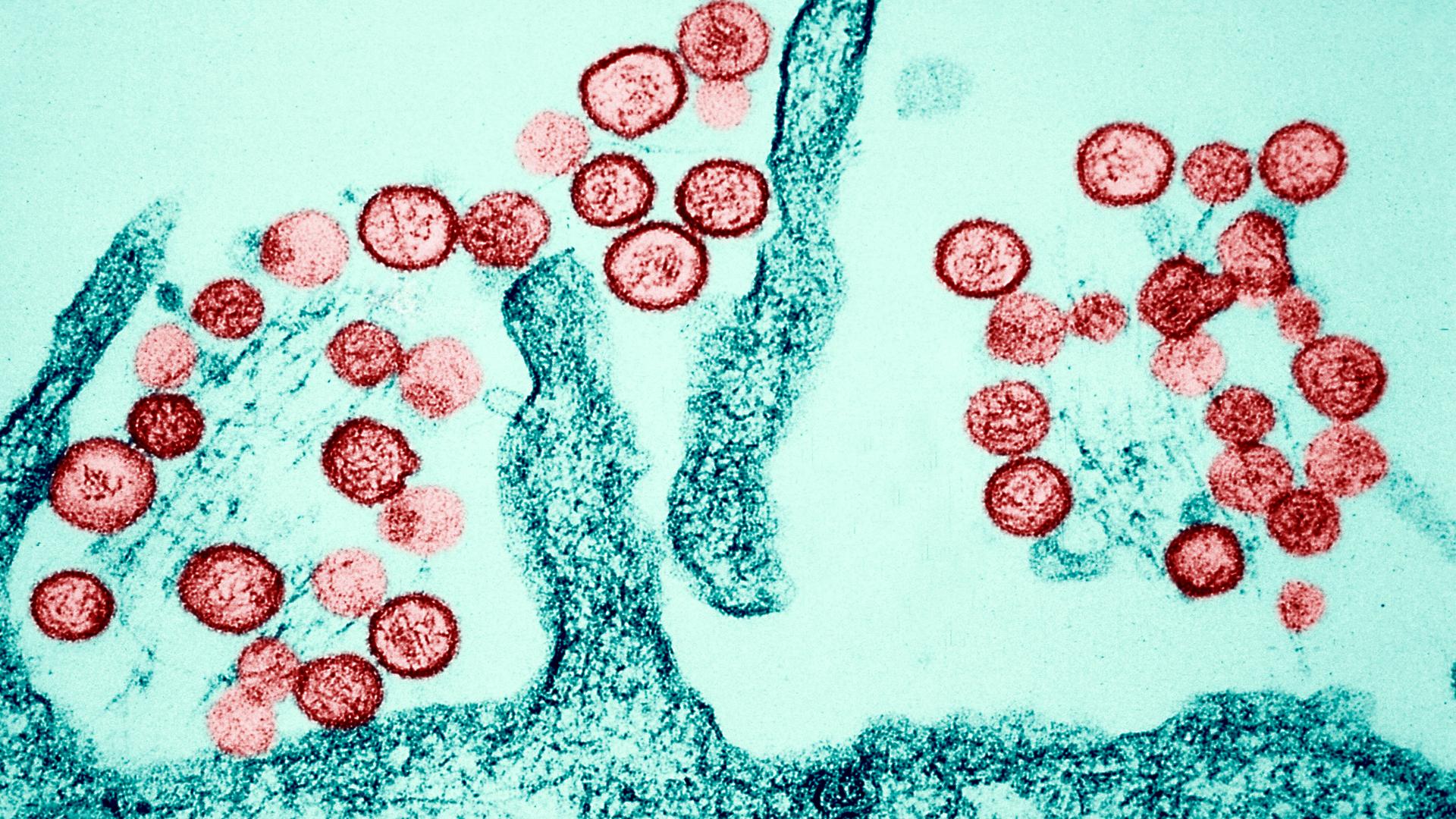 Transmissionselektronenmikroskopische Aufnahme des Sin-Nombre-Hantavirus. Eine farbige Aufnahme mit roten und grünen Zellen.