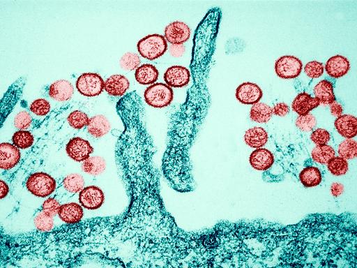 Transmissionselektronenmikroskopische Aufnahme des Sin-Nombre-Hantavirus. Eine farbige Aufnahme mit roten und grünen Zellen.