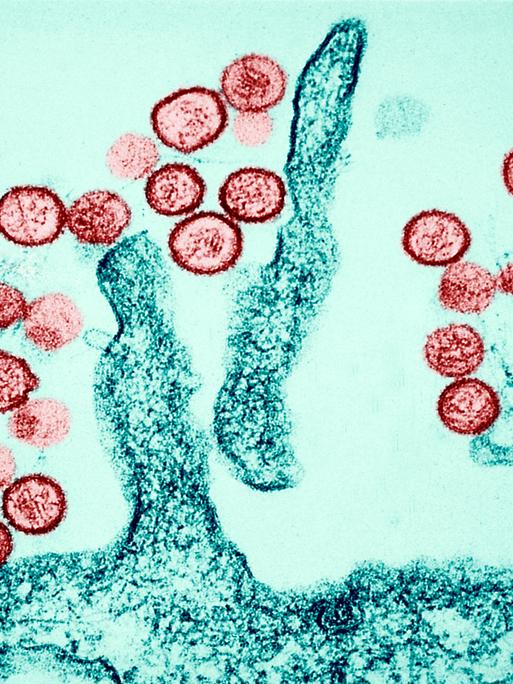 Transmissionselektronenmikroskopische Aufnahme des Sin-Nombre-Hantavirus. Eine farbige Aufnahme mit roten und grünen Zellen.