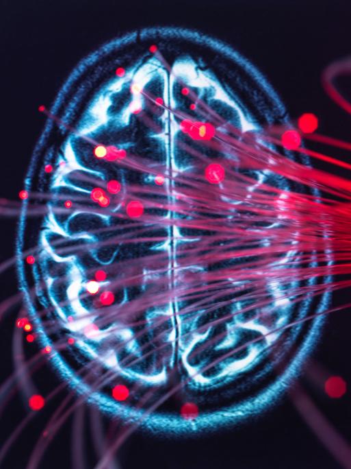 MRT-Scan eines Gehirns mit vielen roten Lichtpunkten unscharf im Bildvordergrund.